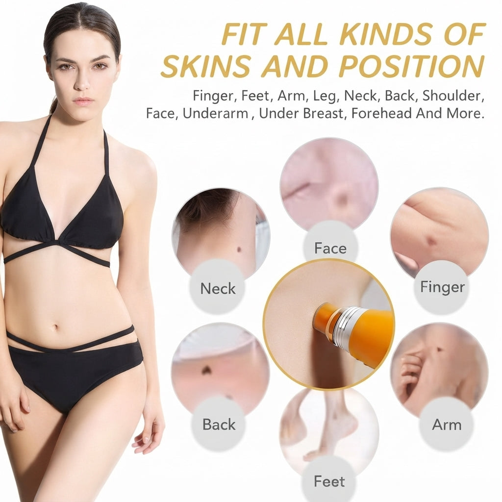 Skin tag and wart remover for body use