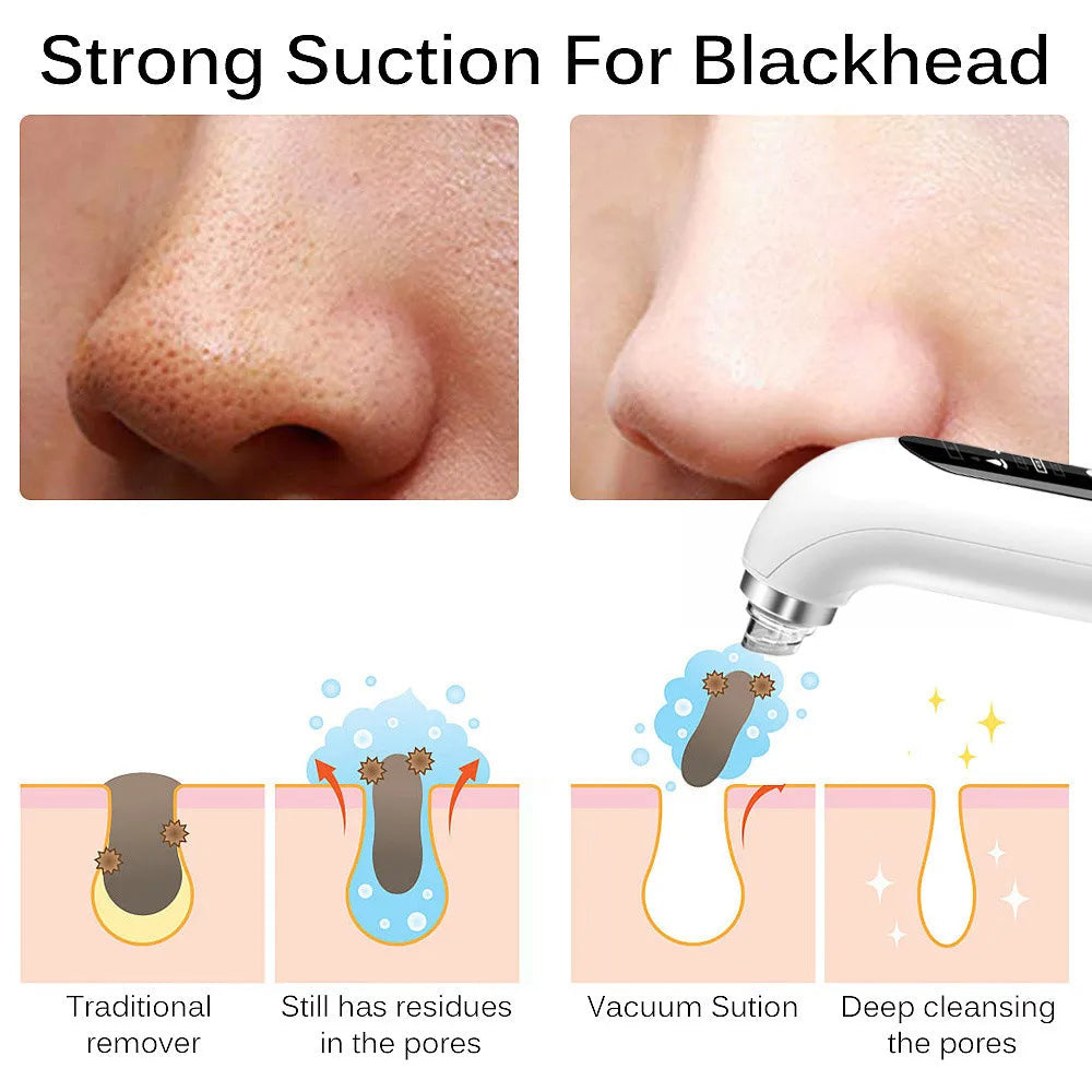 Pore Cleanser With Interchangeable Heads And Suction Settings