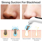 Pore Cleanser With Interchangeable Heads And Suction Settings
