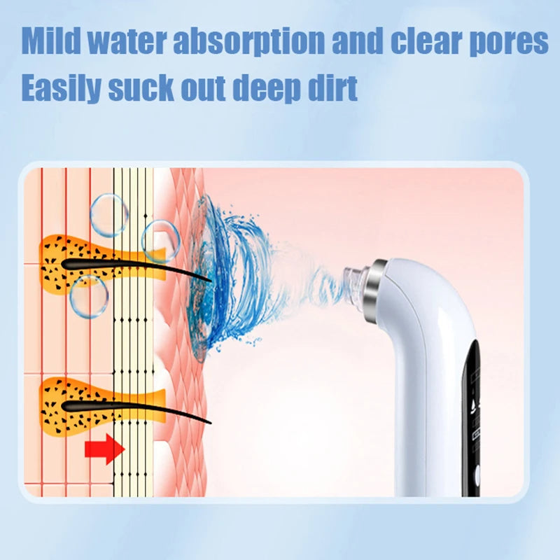 Pore Cleanser With Interchangeable Heads And Suction Settings
