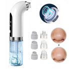 Pore Cleanser With Interchangeable Heads And Suction Settings