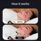 Sleep Device Chin Strap Anti Snoring Aid