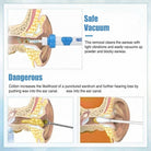 Ear Wax Remover With Silicone Tips And Suction