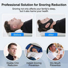 Chin Strap Adjustable Nighttime Sleep Support